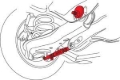 Picture of SPC Performance Mazda3 Rear Camber/Toe Kit